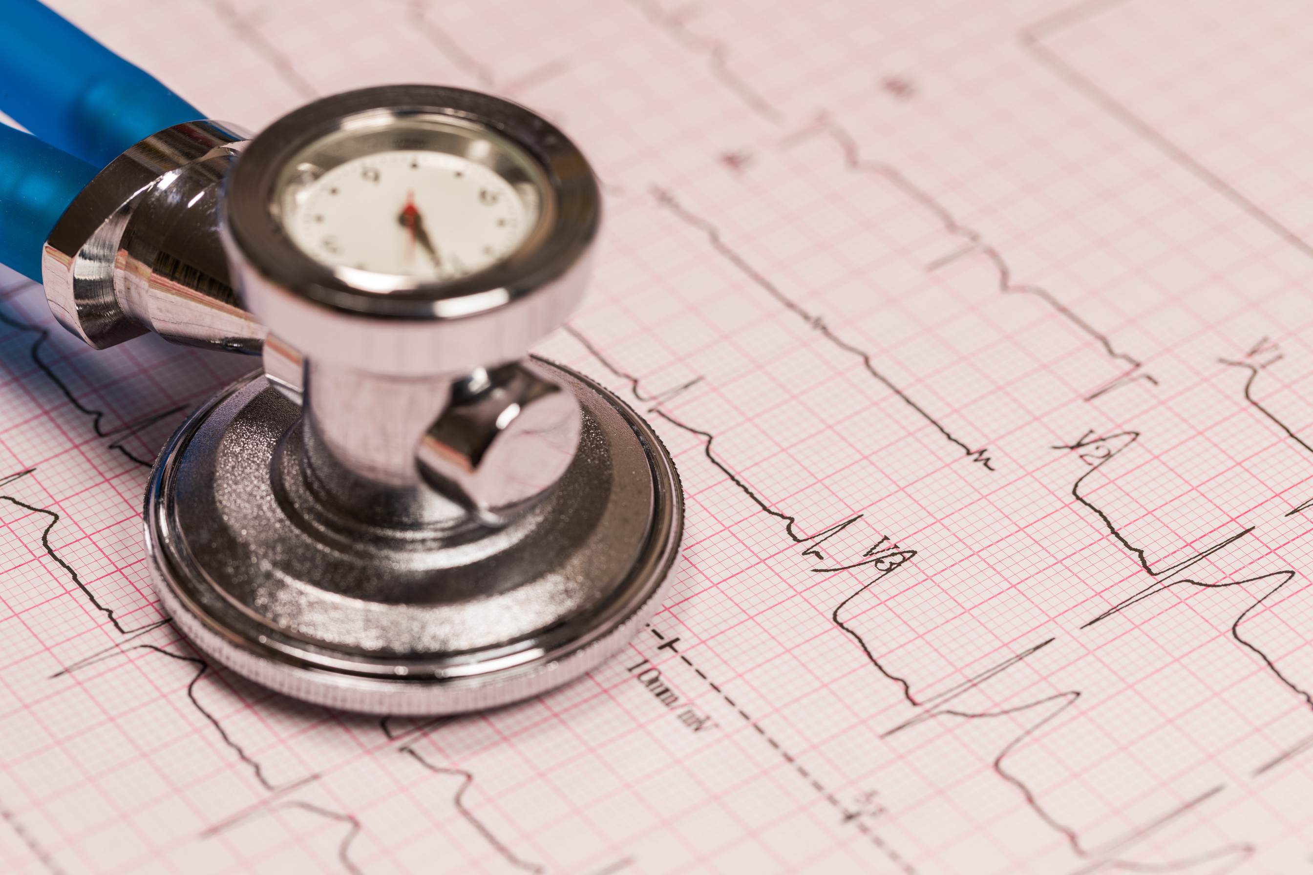 Electrocardiogram