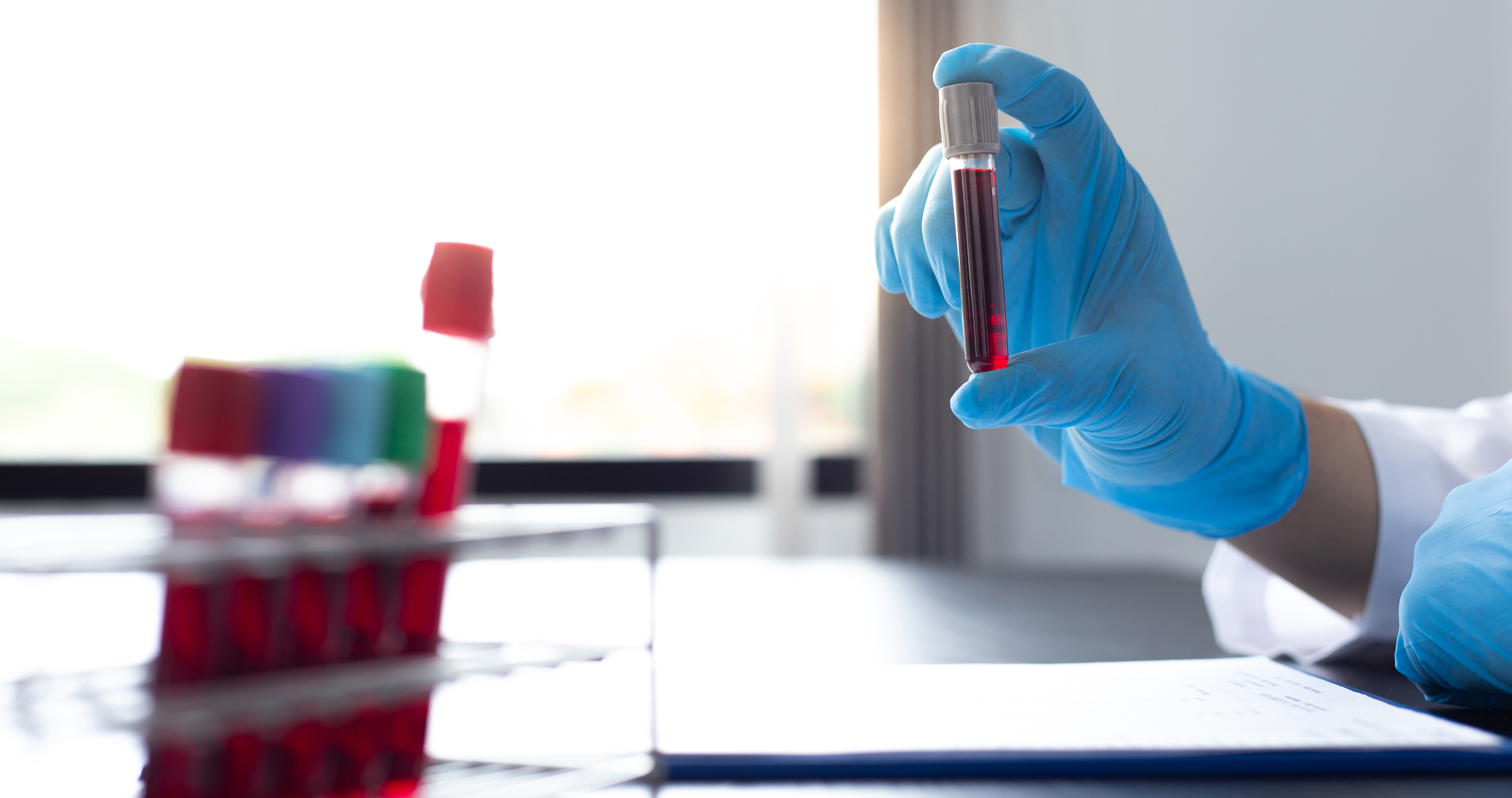 Blood Samples for Laboratory Tests